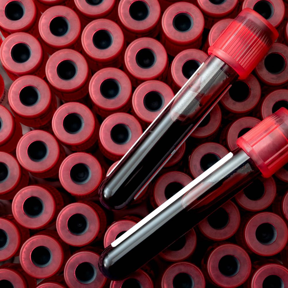 PHLEBOTOMY