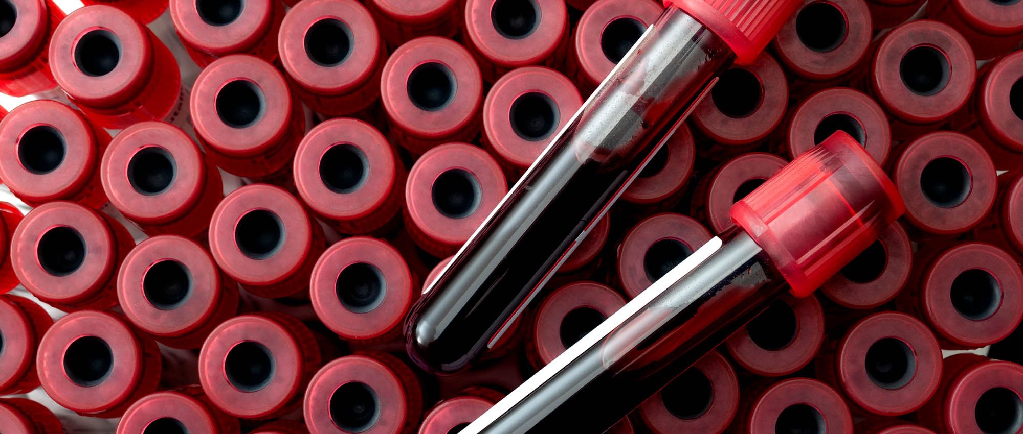 photo of vials of blood Phlebotomy